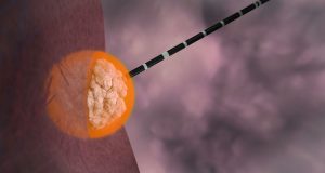 A Healthy Microwave 2