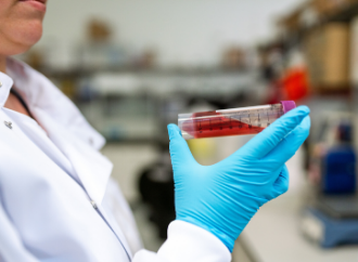 High cholesterol study