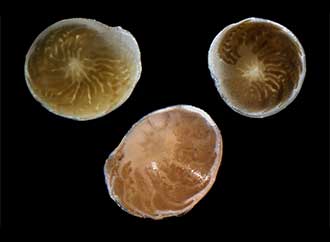 Amphistegina collage