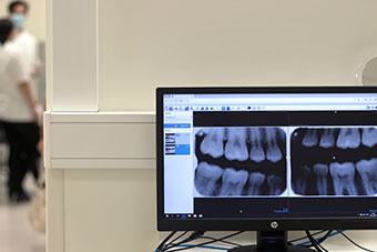 Picture of a computer showing a dental x-ray