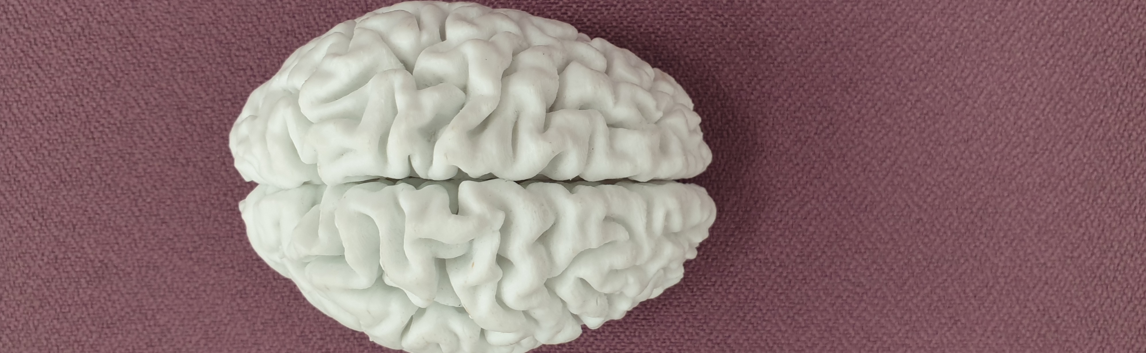 3d printed brain