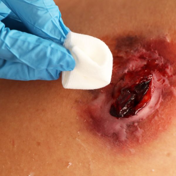 22.08.18 mh TDS Wounds Cardiff UNIV 16