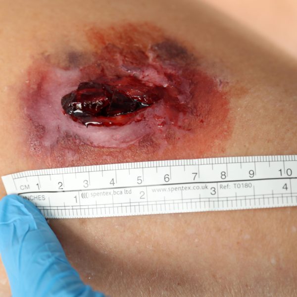 22.08.18 mh TDS Wounds Cardiff UNIV 23