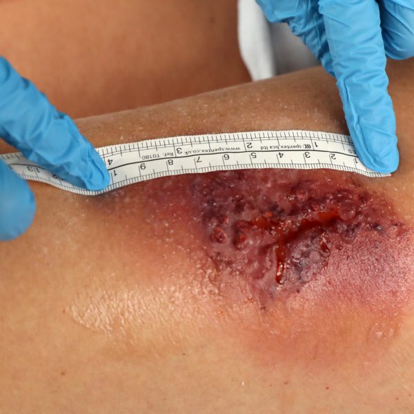 22.08.18 mh TDS Wounds Cardiff UNIV 49